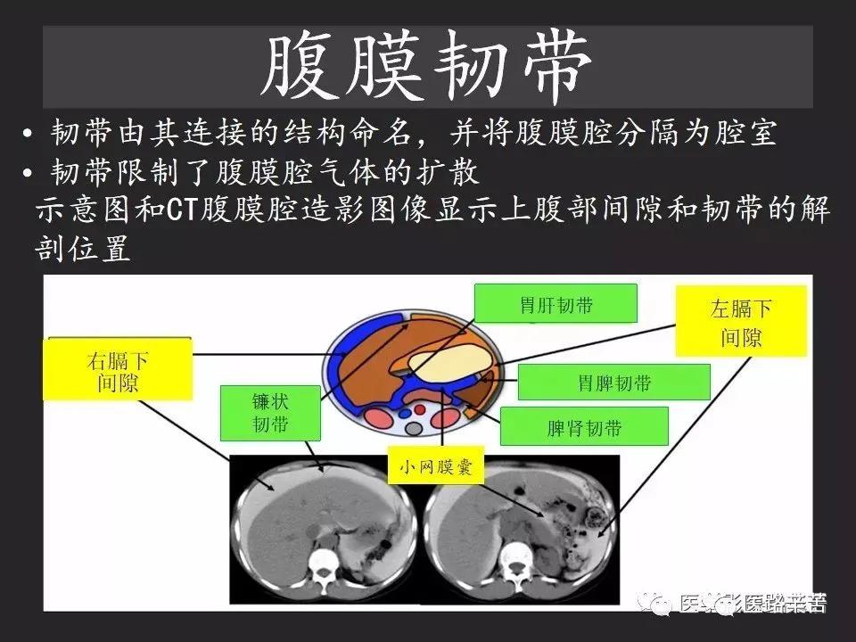 空腔脏器穿孔和胃肠道穿孔区别,腹膜后穿孔一般是哪里穿孔