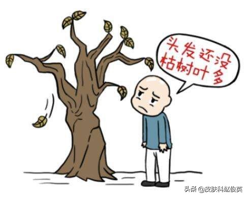 脱发用什么药外用可以防脱,用药能治疗脱发