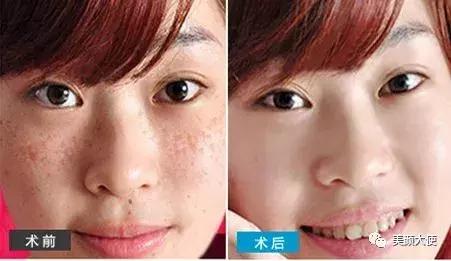 什么是白脸娃娃,什么是瓷娃娃