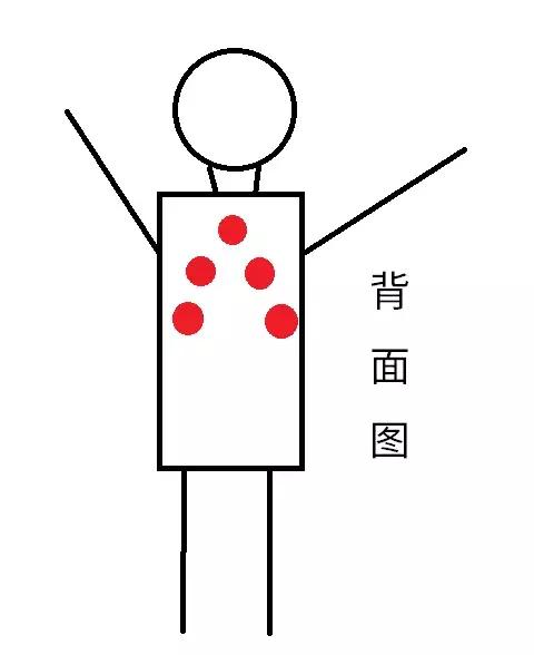 贴三伏贴皮肤被烧伤,有三伏贴灼伤恢复的吗