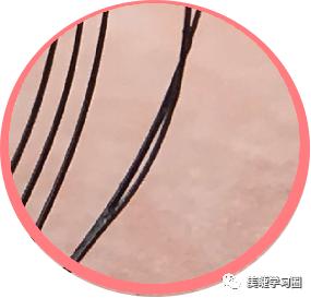 睫毛长扎眼睛该如何处理,睫毛长扎眼睛怎么办小妙招