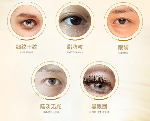 为什么眼睛大会显老？黑眼圈、眼袋、眼纹怎么去除？这两招就够了