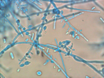 高温高湿季节怎么防止病害,高温高湿天怎么缓解