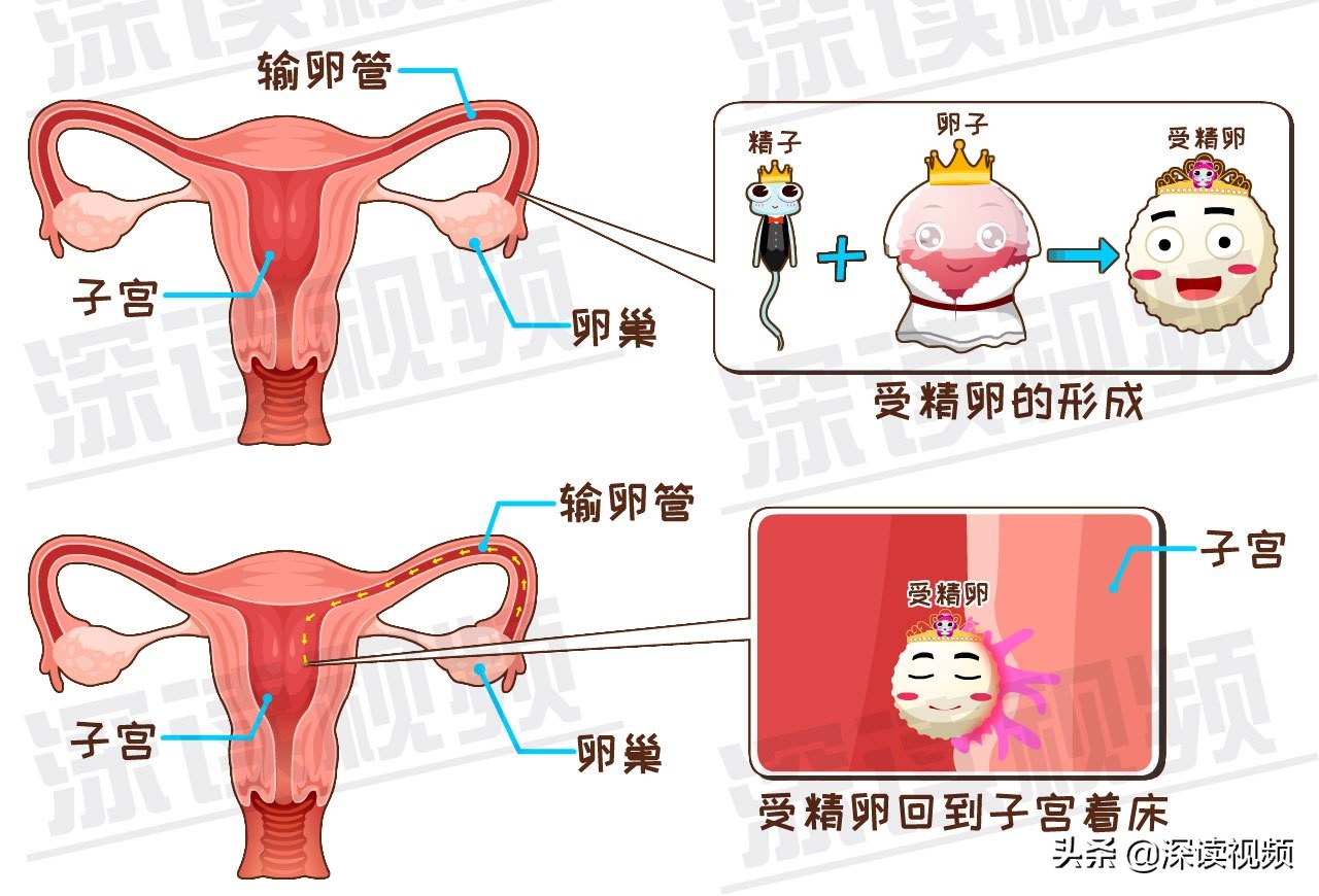 受精卵缘何子宫外安家