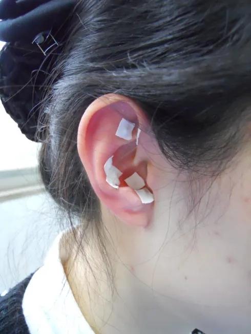 化疗后恶心呕吐怎么可以缓解,化疗后怎么避免恶心呕吐