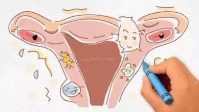 月经前白带增多是正常症状吗,月经来潮前白带有点黄是正常的吗