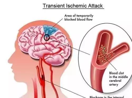 干细胞逆转肺纤维化,干细胞逆转肾病