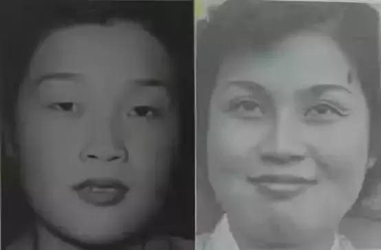 双眼皮真的有那么漂亮吗,自然双眼皮和割的双眼皮内在区别