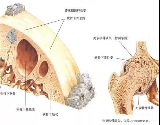 慢性疼痛药物治疗新进展,干细胞疗法治疗慢性疼痛