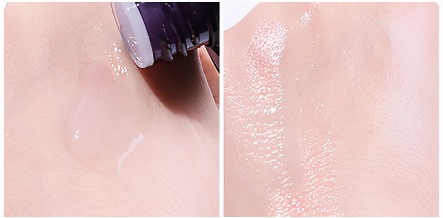 秋季皮肤干燥补水有刺痛感,秋季皮肤过敏保湿水乳