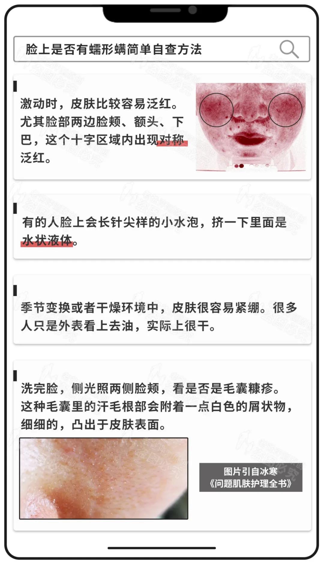 脸上发现蠕形螨虫,别人脸上的螨虫会爬到自己身上