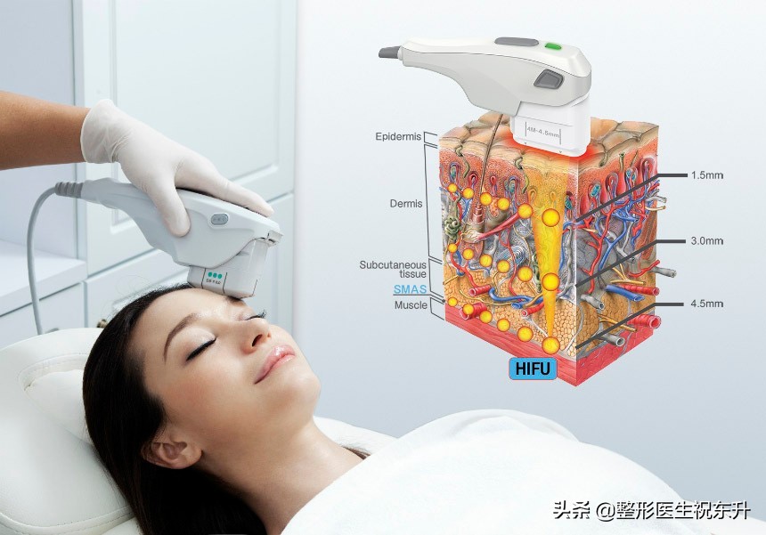 超声刀和热玛吉有必要都做吗,超声炮热玛吉热拉提哪个效果好