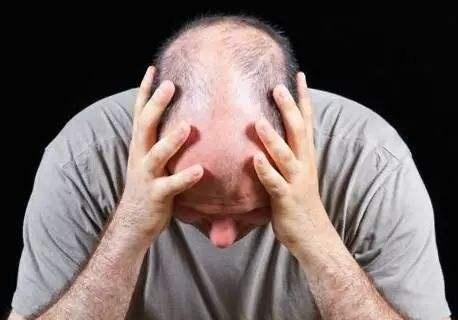 脱发严重怎么使毛囊再生,脱发看毛囊如何判断脱发的原因