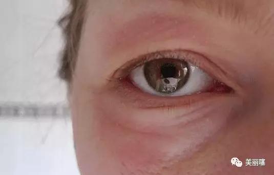 纹绣师操作美瞳线应该注意什么,为什么纹绣师不做美瞳线