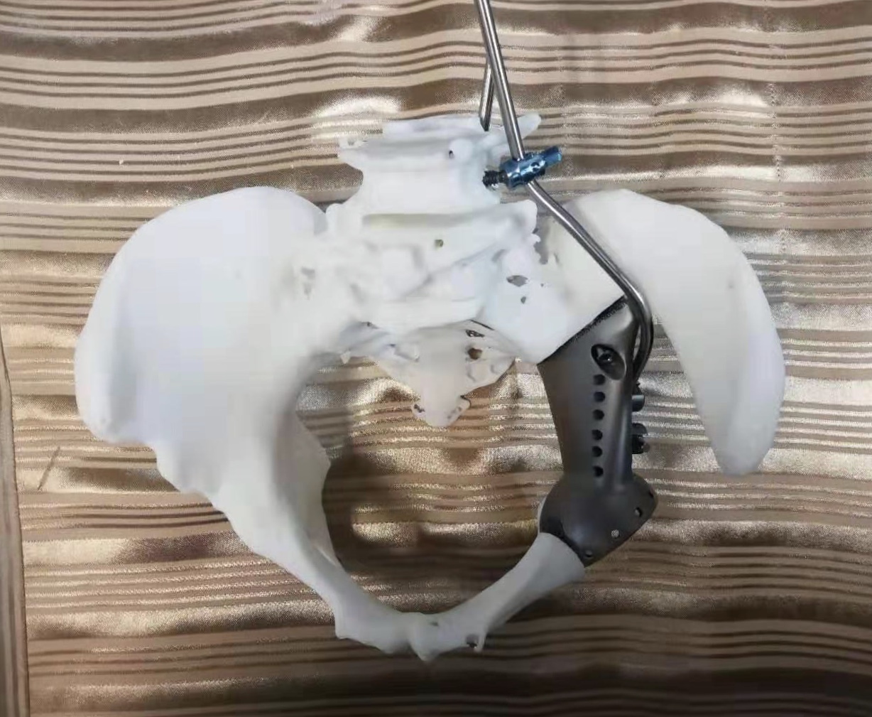 华西医院用3d打印为患者重建腰椎,四川省人民医院三维医学影像