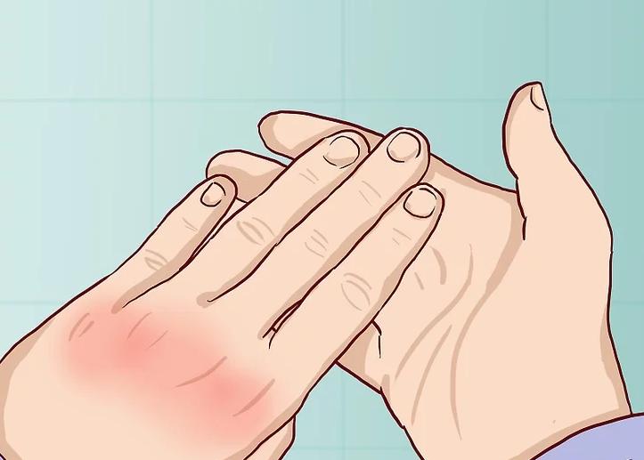 手骨折反复疼痛怎么办,手痛了一个月是骨折吗