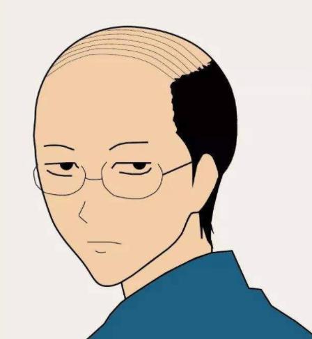 头发贴头皮显脸大怎么处理,扁塌稀疏头发怎么变蓬松