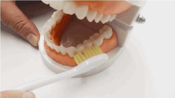 孕期口腔疾病怎么治,孕期严重的口腔问题如何缓解