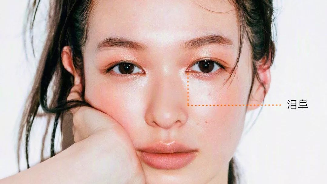 从美术角度谈眯眯眼,开内眼角传统术式