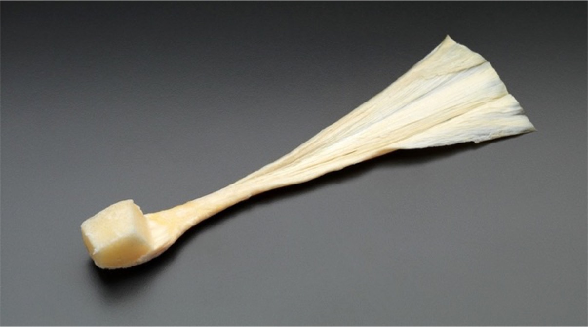 膝盖前叉韧带重建怎么康复,重建膝关节前交叉韧带多久能行走