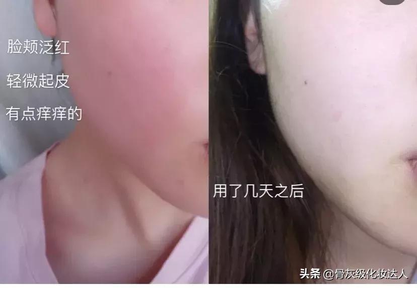 你的水乳上榜了吗,你的秋季水乳上白名单了吗