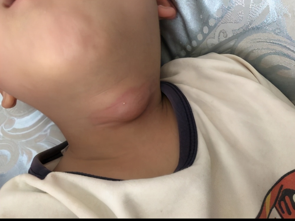 弓形虫怎样从动物中传染到人类,弓形虫的主要宿主