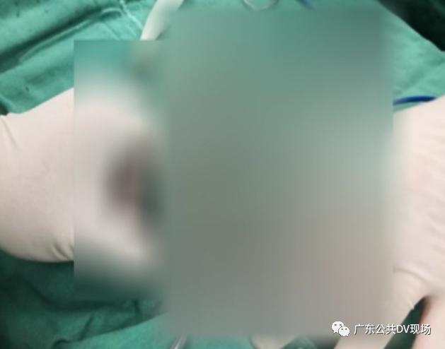 “蛋蛋”的忧伤！男孩突然“蛋疼”不止，隔天送医被切除，医生提醒