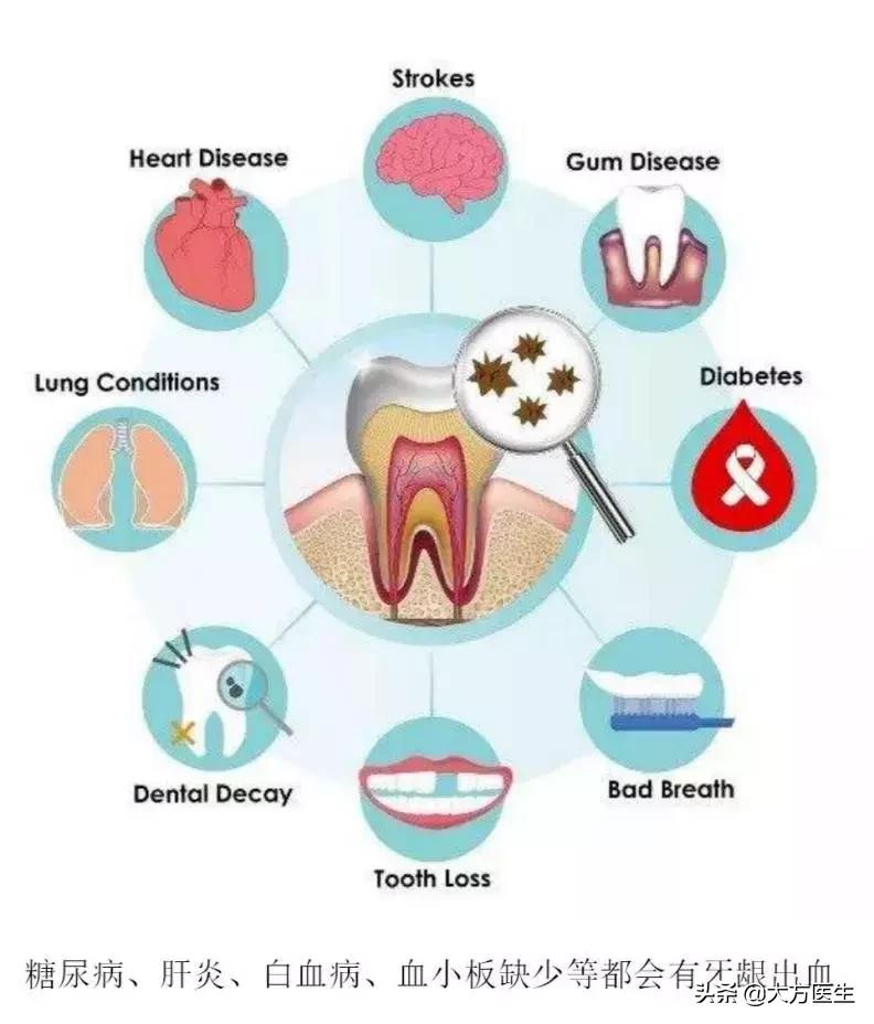 经常牙龈出血且口臭,牙疼引发牙龈出血一吸就满口血