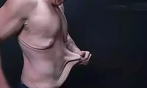 皱纹老化下垂怎么办,眼皮松弛下垂皱纹多最好解决方法