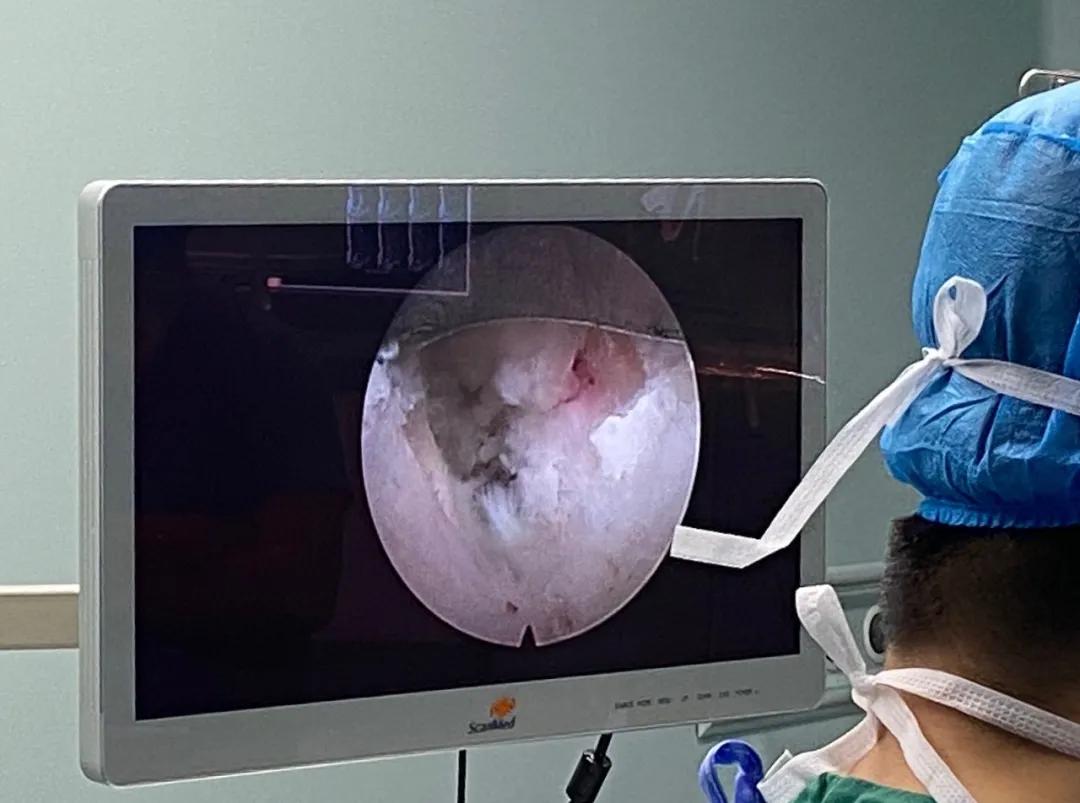 渭南治腰间盘突出哪家最好,脊柱神经外科手术