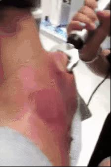 撞树、火疗、喝尿....谁是土法养生界的霸主？