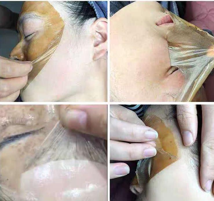 斑点肌肤怎么改善,皮肤暗黄斑点怎么调理