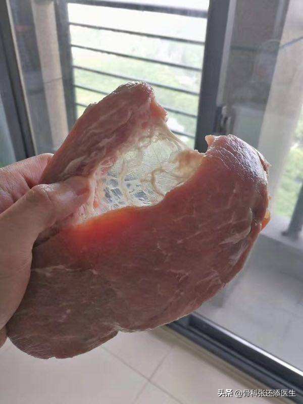 脚后跟走路疼但是没有肿起来,脚后跟走路不疼跑步疼