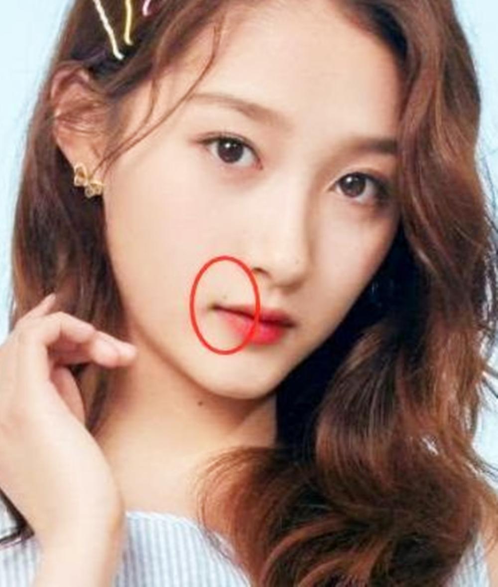 不同地方的痣分别代表着什么,不同地方的痣表示的是什么样的人