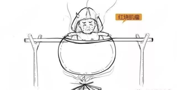 子宫肌瘤动漫演示,子宫肌瘤是什么原因导致的漫画