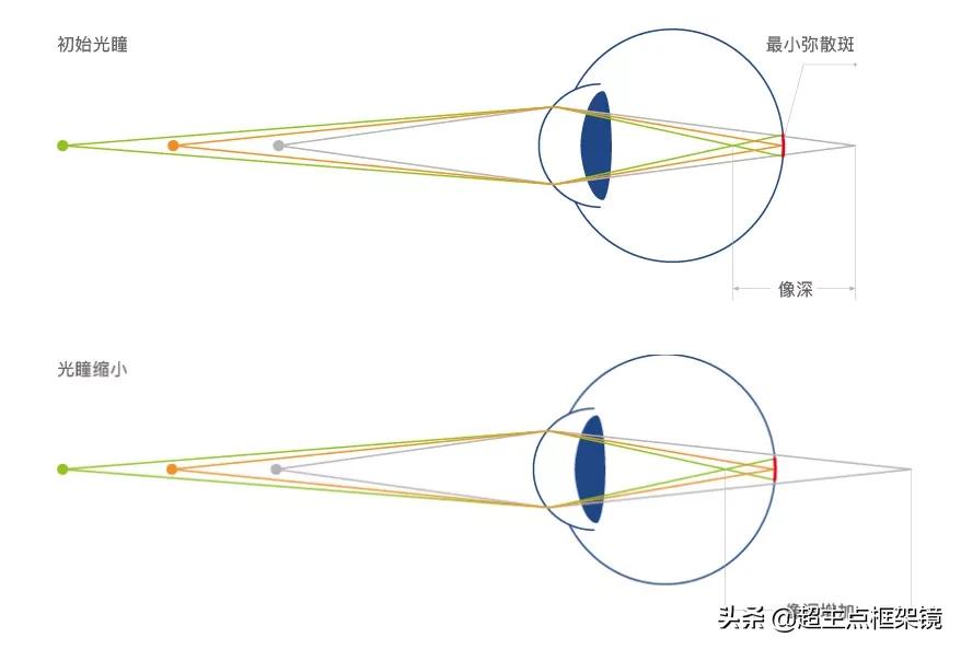 近视矫正仪器对儿童近视有用吗,儿童近视100度戴矫正镜有用吗