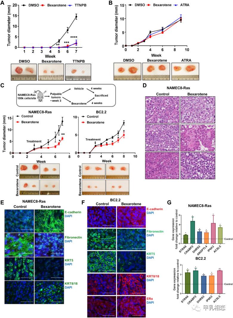 维甲酸能治疗什么病,乳癌早期化疗ac和tc哪个方案好