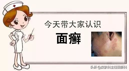 脸上痘印变成癣了怎么回事,痘印长癣