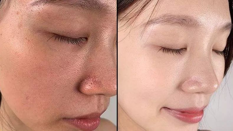 治脚冷的最有效偏方,老中医教你脚暖