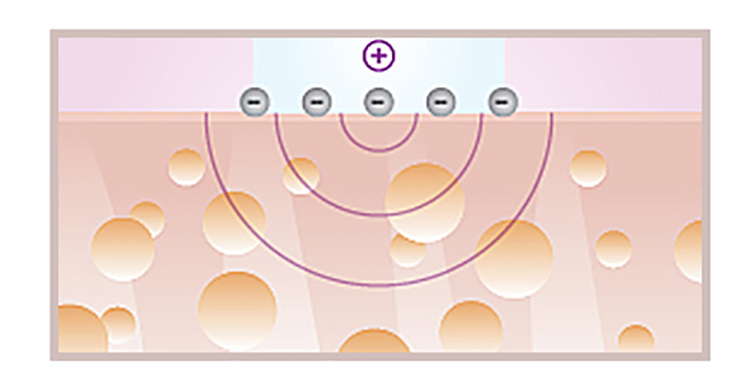 夏季混干皮如何美白,干皮美白用什么效果好女士