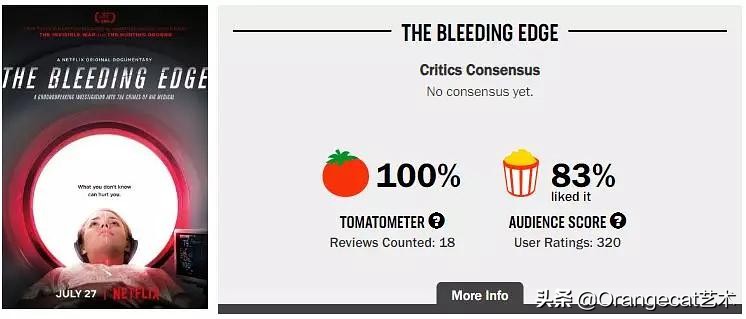 美国尖端医疗纪录片,纪录片尖端医疗