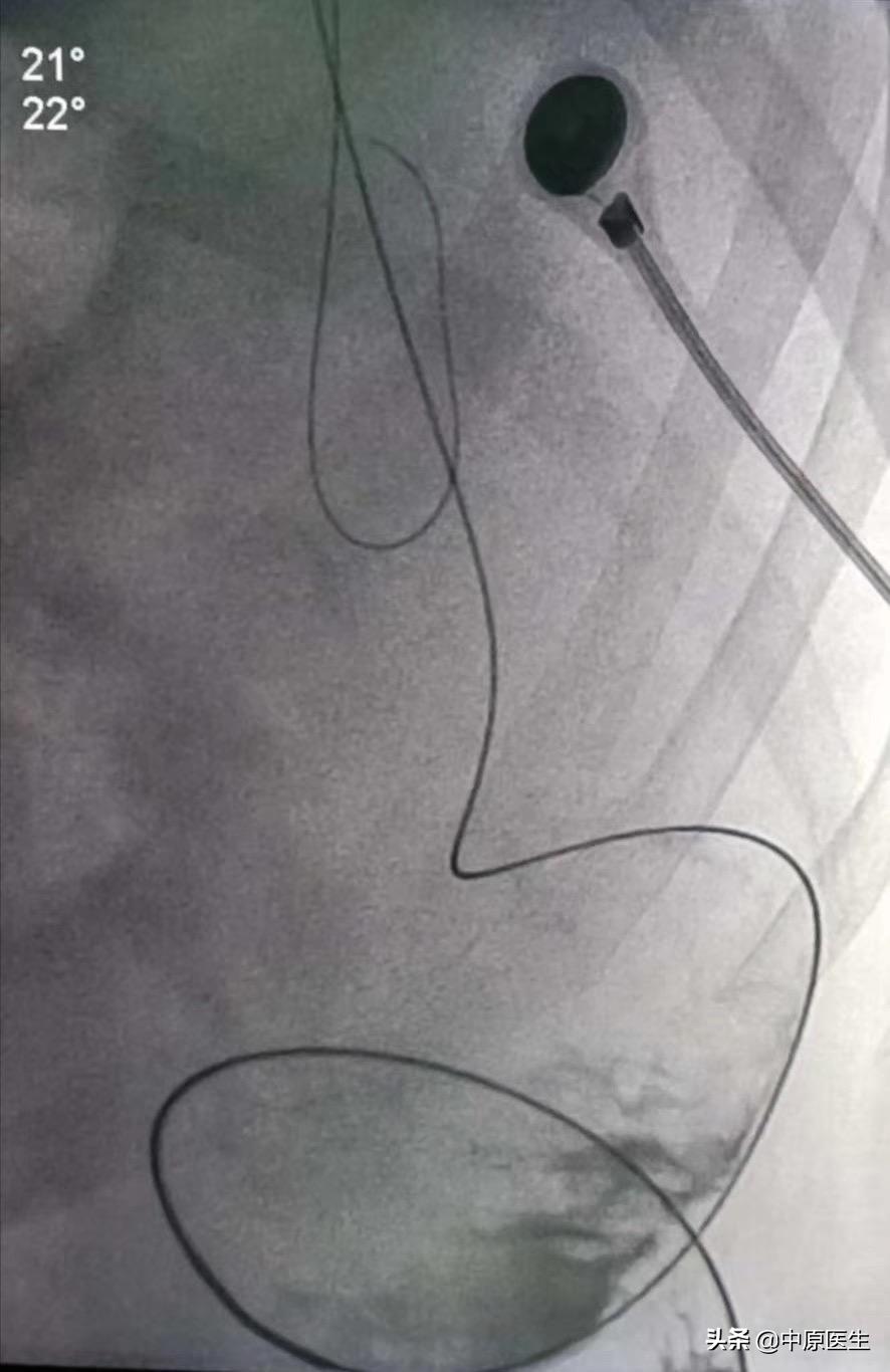 手术室没想象中的那么可怕,手术室没有想象的那么可怕