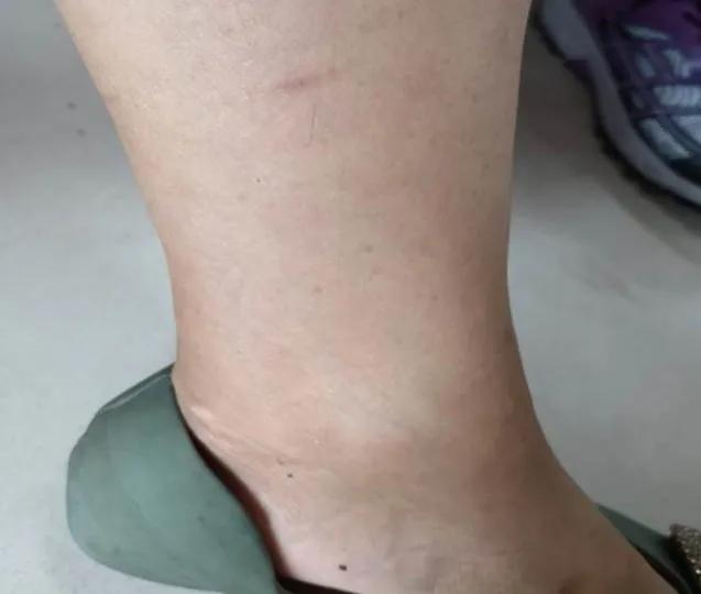 许家栋经典经方医案,许家栋经典经方治脾胃病