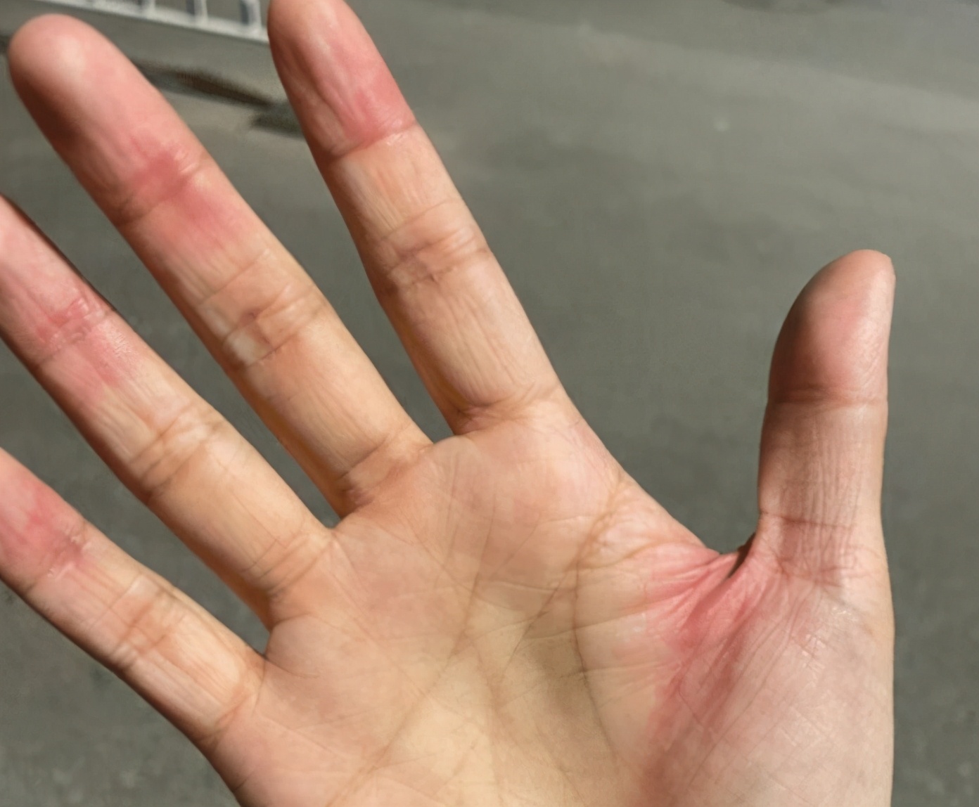 泰国一男子因被iphone12手机割破手指发帖惹果粉怒怼