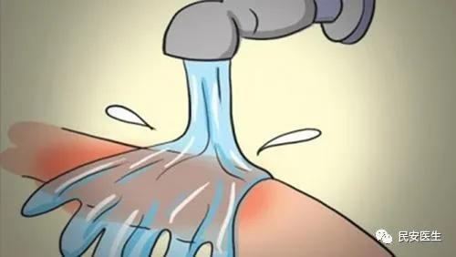 右小腿烧烫伤处理操作视频,老人烧烫伤急救处理方法