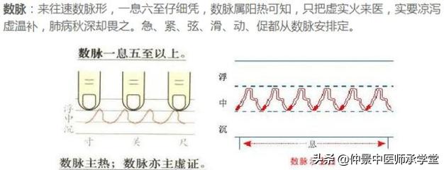 中医讲迟脉,中医脉诊迟脉是代表什么