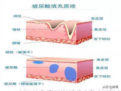辛芷蕾是苦相女生吗,辛芷蕾气质怎么养成