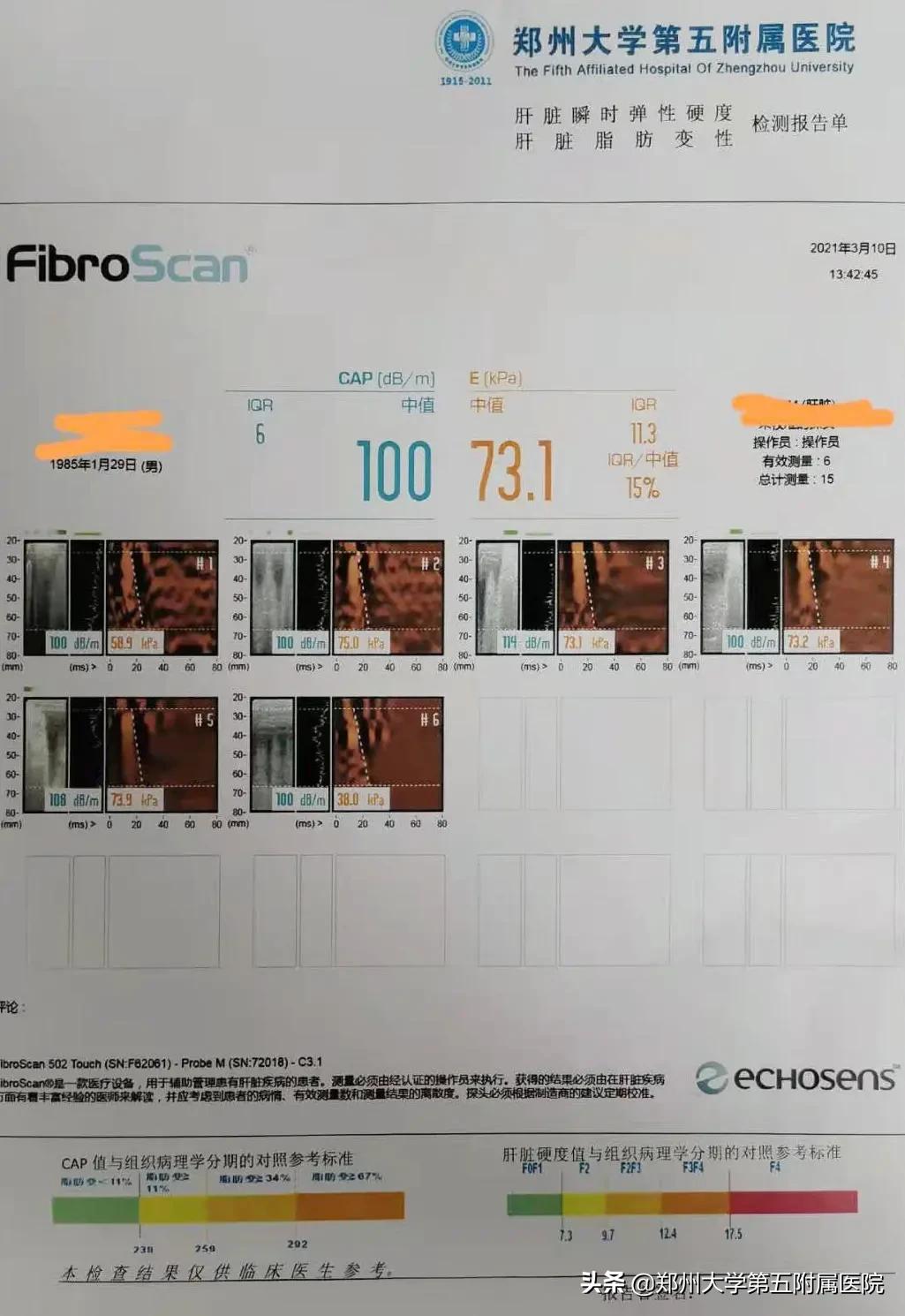 全国爱肝日维护肝脏增进健康,全国爱肝日护肝最应警惕祸从口入