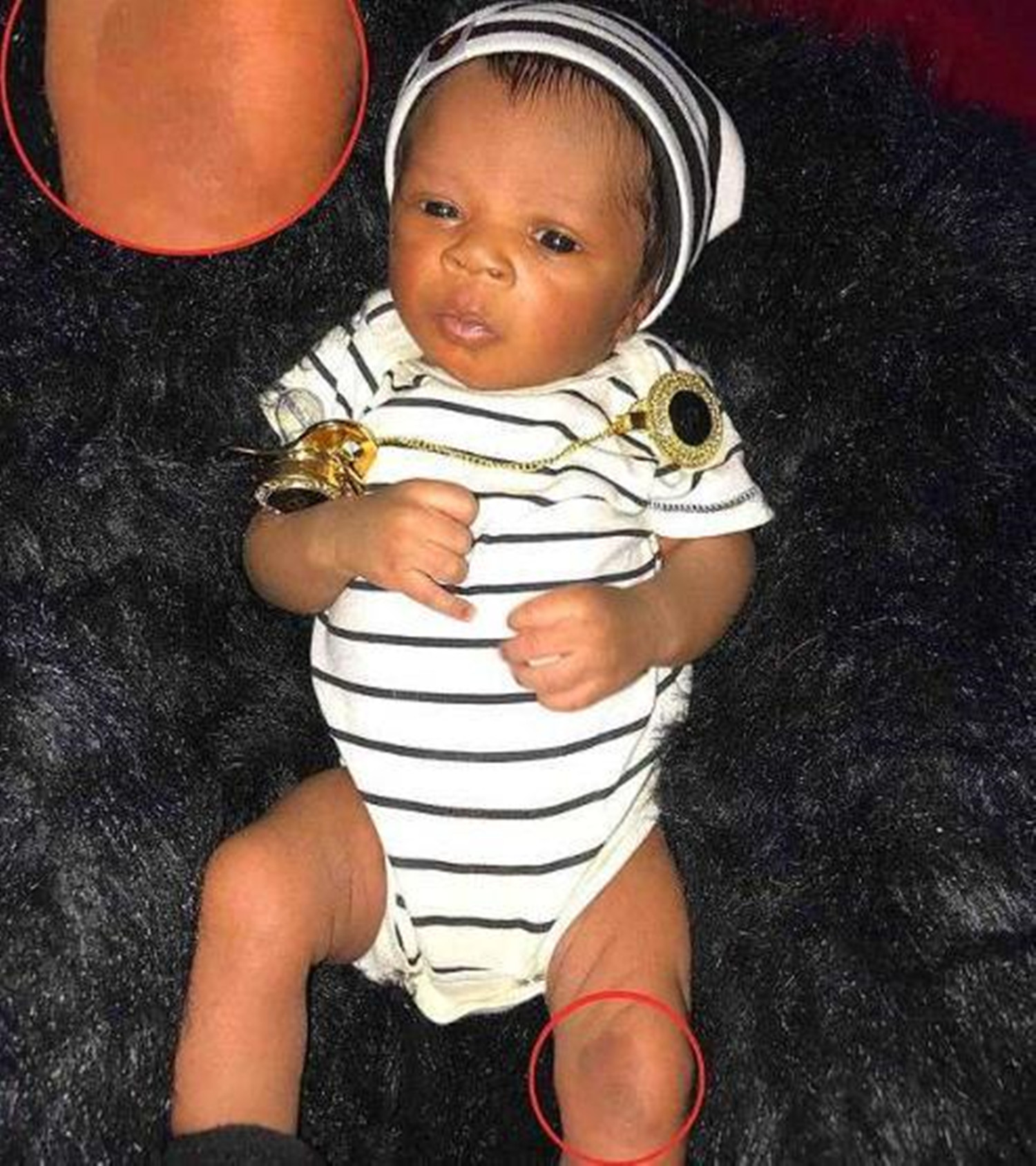 龙凤胎姐姐腹中被“吸收”，B超影像留弟弟腿上，网友：最美胎记