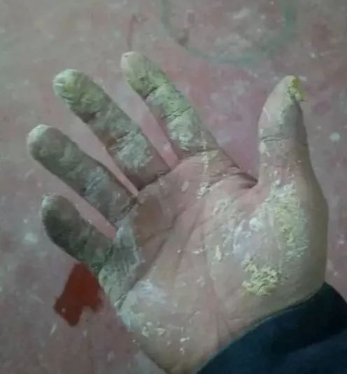 当别人问你上班吗如何回答,做喷漆工久了会怎样